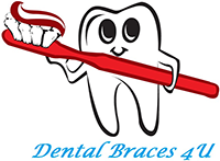 Dental Braces 4 U